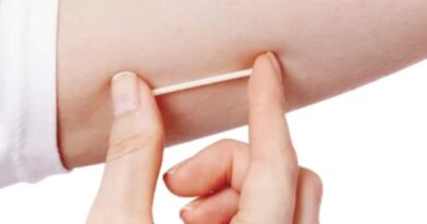 MULHERES EM IDADE FÉRTIL – SUS oferecerá implante contraceptivo a partir do segundo semestre.