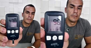 VIRALIZOU – Nutricionista mostra diferença da glicose no sangue antes e depois de lavar as mãos.