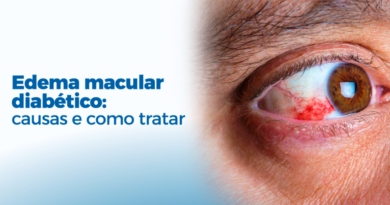 EDEMA MACULAR DIABÉTICO – Quando a visão central começa a falhar.