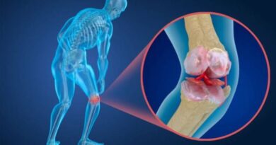 SAÚDE FEMININA – Menopausa e osteoporose: como proteger os ossos
